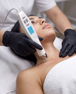 Dermapen EPN z elektroporacją